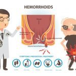 Hemoroid, Pembesaran Pembuluh Darah Anus